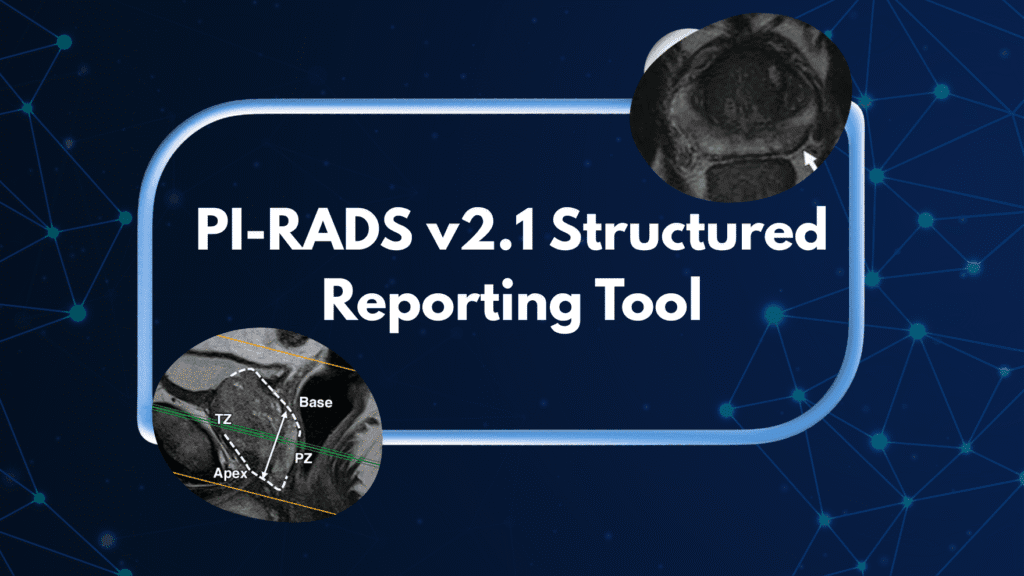 PI-RADS v2.1 Structured Reporting Tool